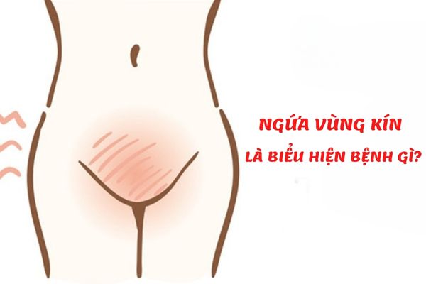 Ngứa vùng kín ở nữ giới là bệnh gì? – Cách điều trị hiệu quả nhất nên biết