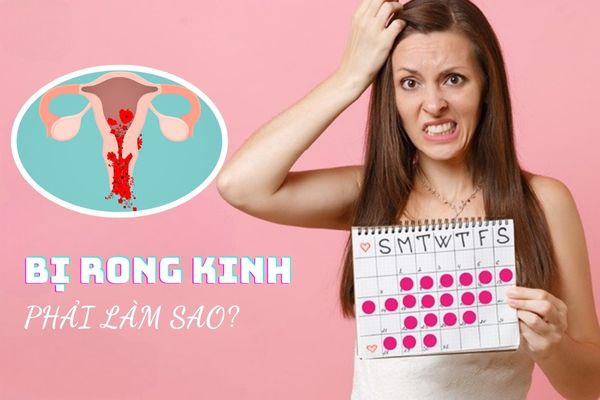 [Giải đáp thắc mắc] Bị rong kinh phải làm sao?
