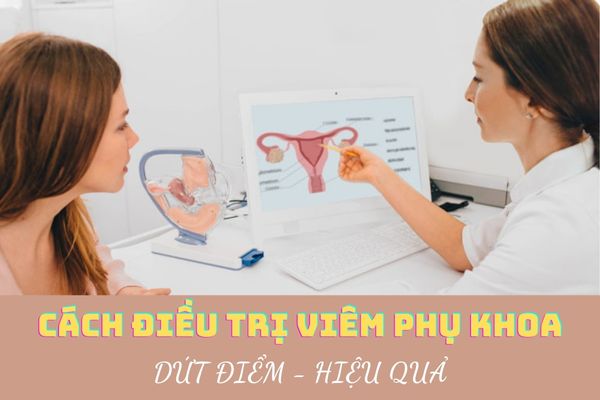Cách điều trị viêm phụ khoa hiệu quả