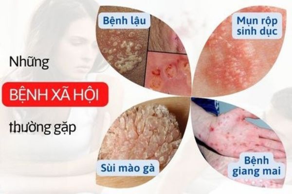 Ngua-2-ben-mep-vung-kin-4