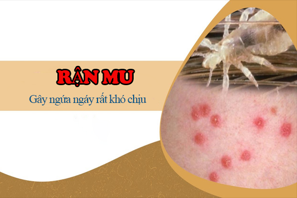 Ran-mu-nhung-thong-tin-quan-trong-ban-can-biet-1
