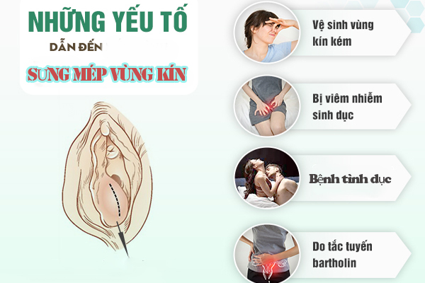 Sung-mep-vung-kin-hien-tuong-bat-thuong-cho-chu-quan