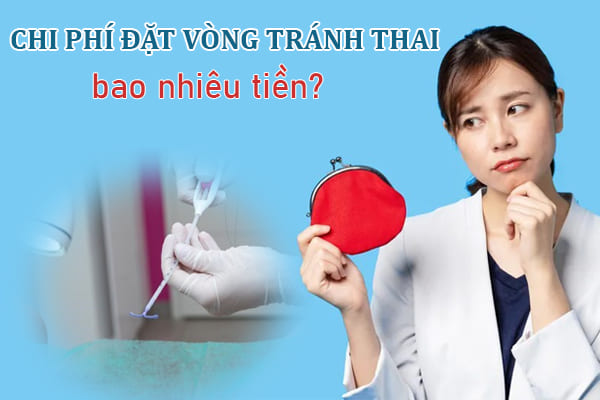 Chi phí đặt vòng tránh thai hết bao nhiêu? Nên đặt vòng ở đâu tốt?