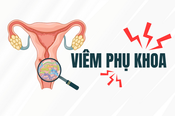 Tìm hiểu về thuốc đặt phụ khoa, viên đặt âm đạo