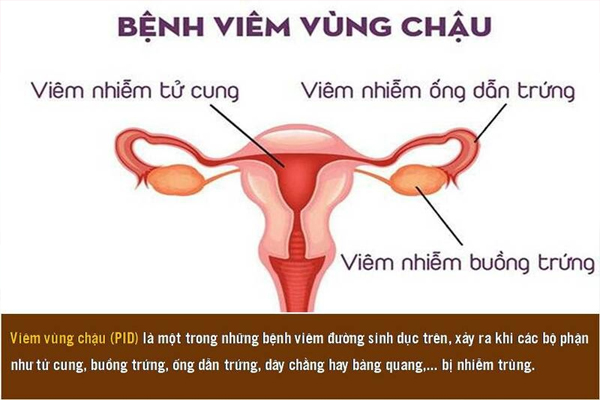 nguyen-nhan-khien-nu-gioi-bi-dau-bung-duoi-sau-quan-he-4