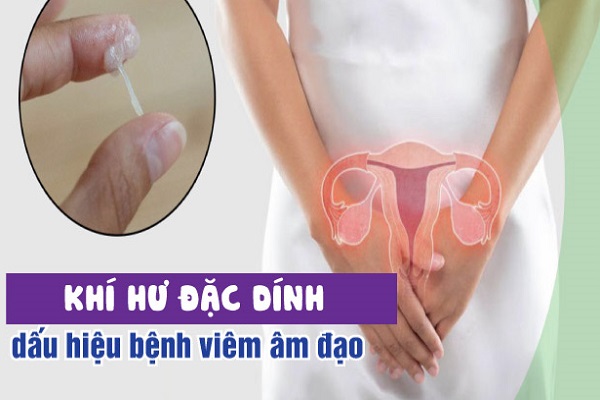 Khí hư đặc quánh có màu trắng là bệnh gì?