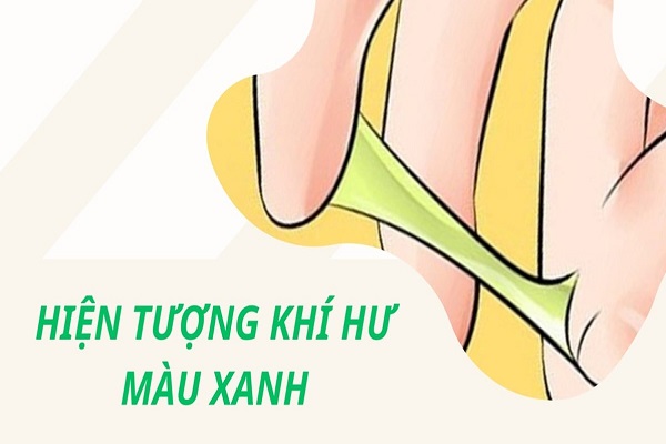 Khí hư màu xanh là biểu hiện của bệnh lý gì?