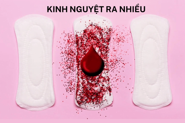 Kinh nguyệt ra nhiều có ảnh hưởng gì không?