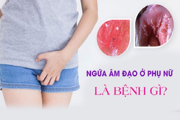 ngua-am-dao-o-nu-la-benh-gi