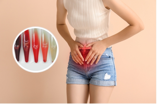 Nước tiểu màu đỏ hồng ở nữ là bị gì?
