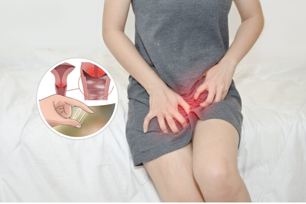Nguyên nhân vùng kín ra khí hư gây ngứa và cách điều trị hiệu quả