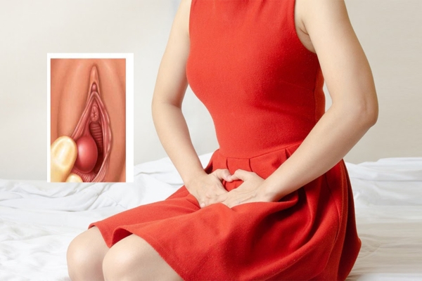 Sưng âm đạo có đáng lo ngại?