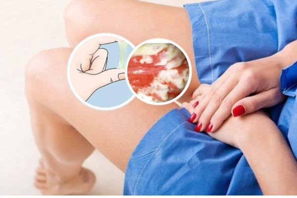 Dấu hiệu nhận biết bệnh viêm âm đạo và cách điều trị hiệu quả