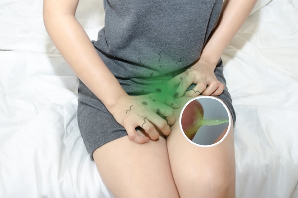 Ra huyết trắng màu xanh là bị bệnh gì?