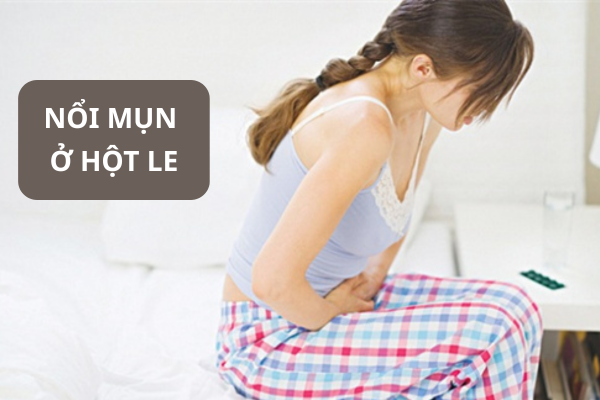 Nổi mụn ở hột le là bị gì?