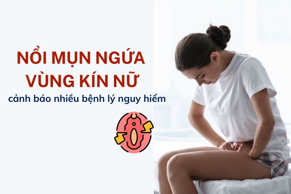 Nổi Mụn Ngứa Vùng Kín – Dấu Hiệu Cảnh Báo Bệnh Phụ Khoa