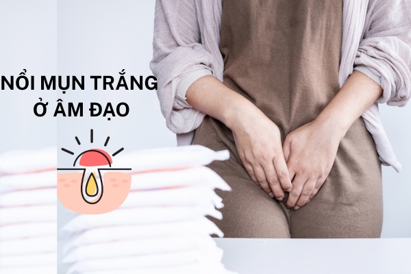 Nổi mụn trắng ở âm đạo là bệnh gì?