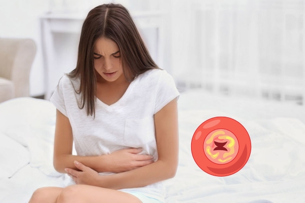 Cách điều trị viêm lộ tuyến cổ tử cung hiệu quả