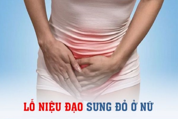 Sưng lỗ niệu đạo ở nữ khám chữa nơi nào hiệu quả, giá thấp?