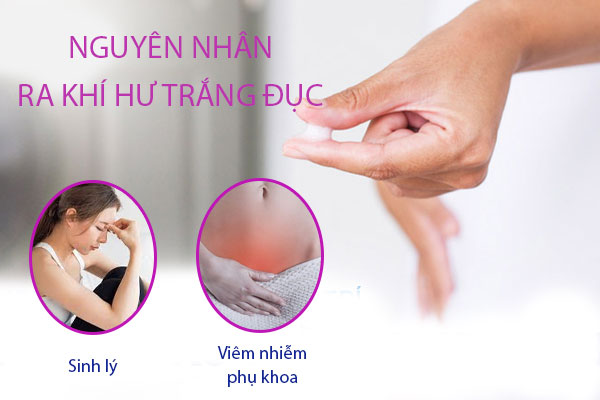 Ra khí hư trắng đục và cách điều trị an toàn hiệu quả