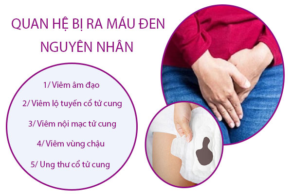 Quan hệ bị ra máu đen nguyên nhân là gì? Lắng nghe chia sẻ từ bác sĩ chuyên khoa