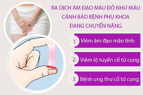 Ra dịch âm đạo màu đỏ như máu: Báo hiệu sức khỏe vùng kín đang nguy cấp