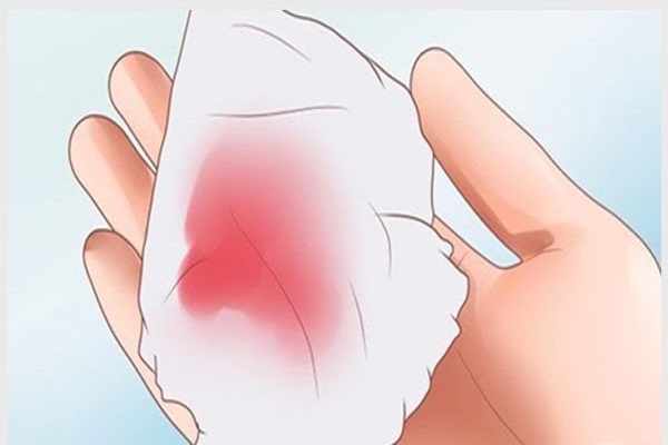 Ra máu sau khi quan hệ nên đến đâu khám chữa?