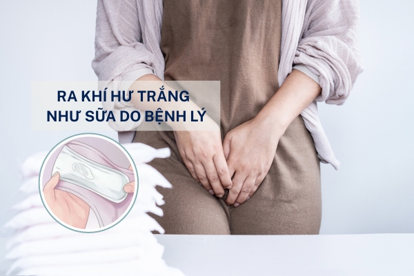 Ra khí hư trắng như sữa – Coi chừng mắc bệnh phụ khoa mà không biết!