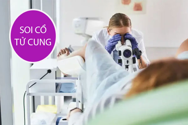 Soi cổ tử cung là gì và khi nào nên thực hiện?