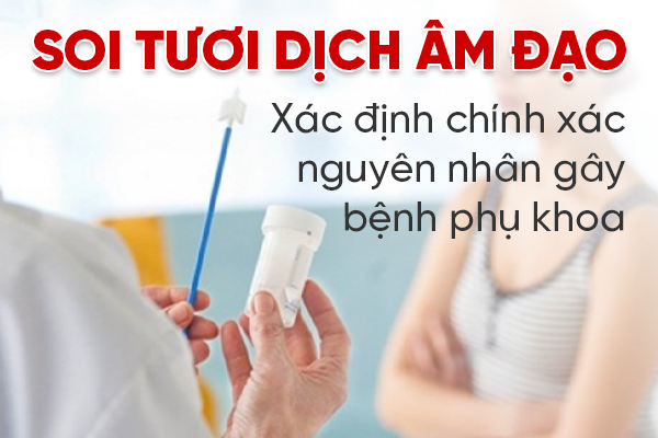 Soi tươi khí hư là gì? Khi nào nên thực hiện và có đau không?